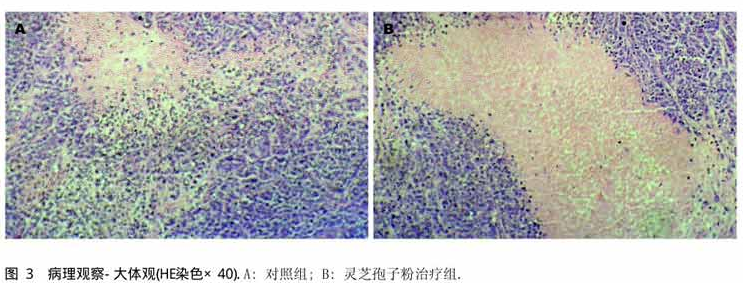 灵芝孢子粉对人肝癌细胞HepG2及裸鼠移植瘤生长的抑制作用-第4张图片-破壁灵芝孢子粉研究指南